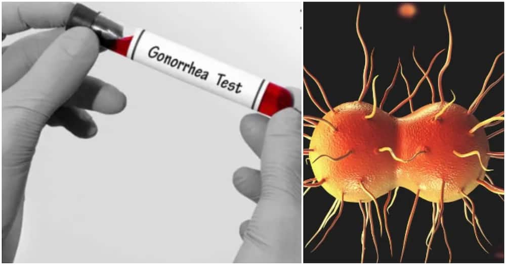 New Strains of Sexually Transmitted Diseases Found in Kenya