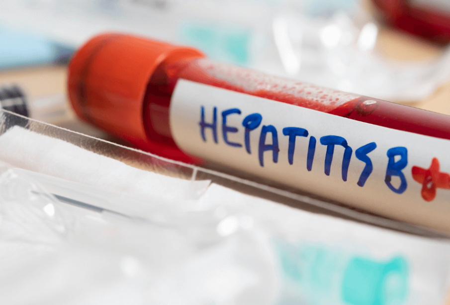 Expert Issues Stark Warning: Hepatitis B Poses 100-fold Greater Infectious Risk Than HIV