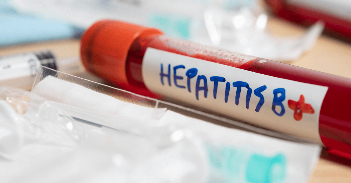 Expert Issues Stark Warning: Hepatitis B Poses 100-fold Greater ...